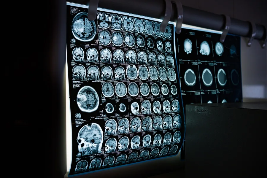 sprzęt który będą projektować studenci x-ray prześwietlanie (fot.pixabay.com)